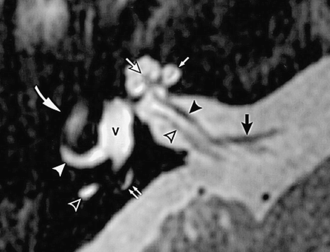 fig 2.