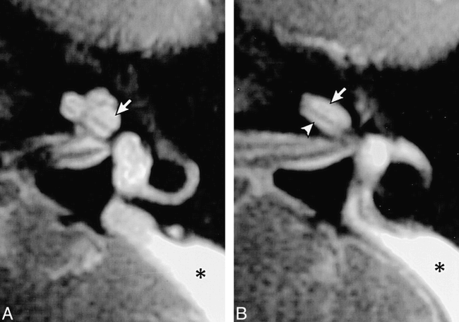 fig 5.