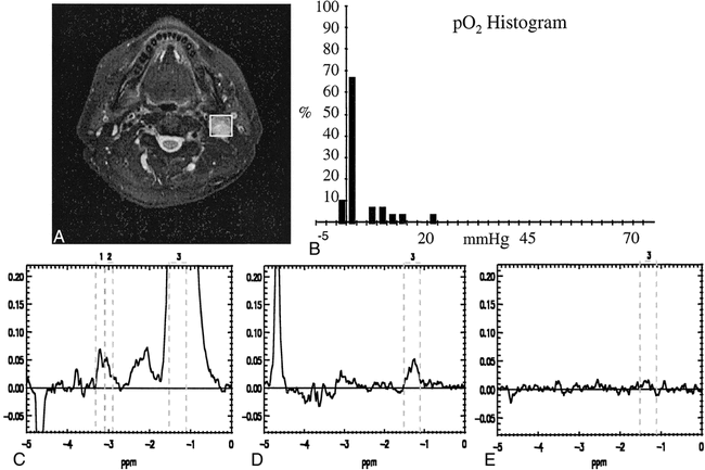 fig 2.