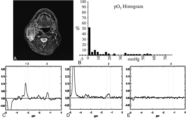 fig 3.