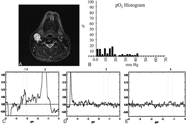 fig 4.