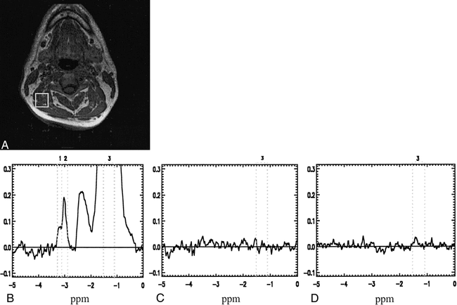 fig 5.