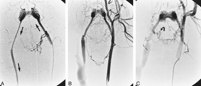 fig 2.