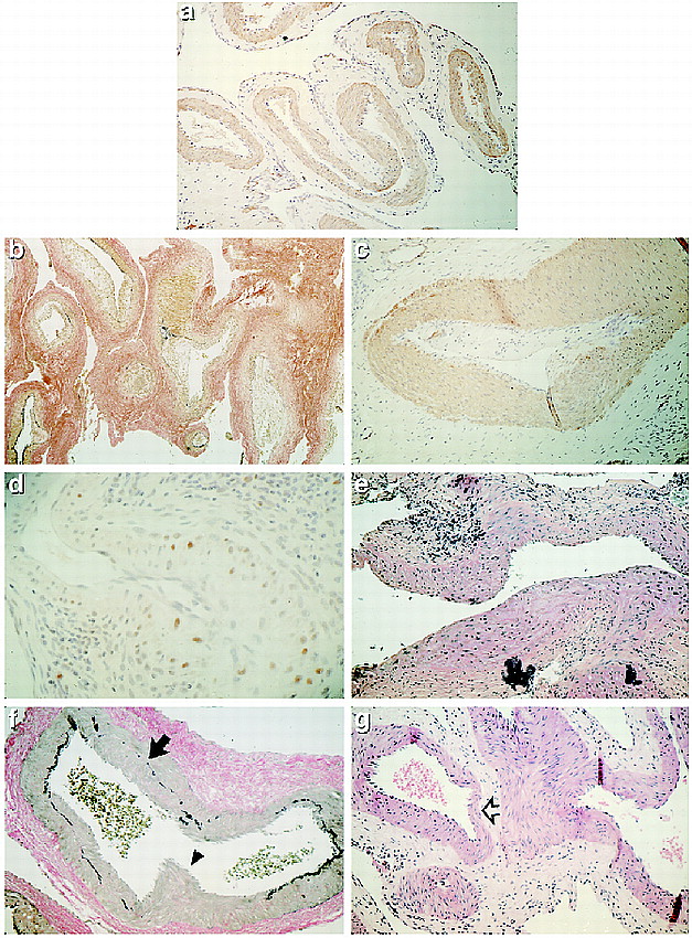 fig 3.