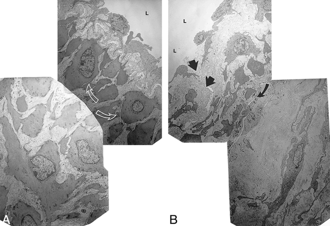 fig 4.