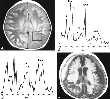 fig 2.