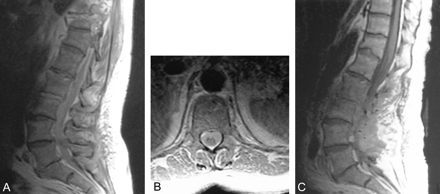 fig 2.