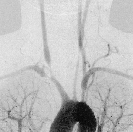 Fig 1.