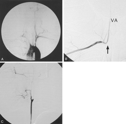 Fig 2.