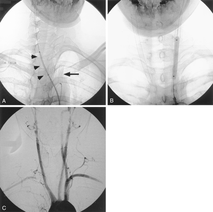 Fig 3.