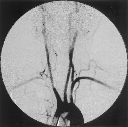 Fig 4.
