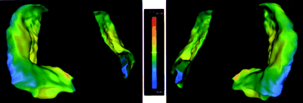 Fig 3.