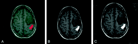 Fig 1.