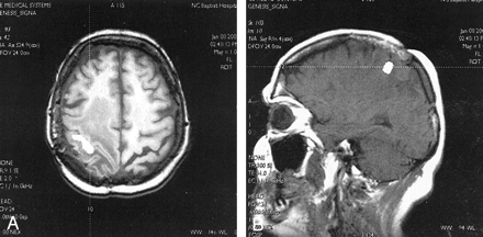 Fig 2.