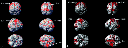 Fig 3.