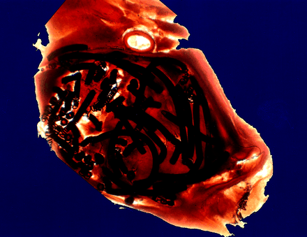 Fig 1.