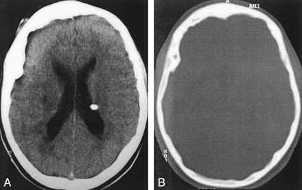Fig 1.