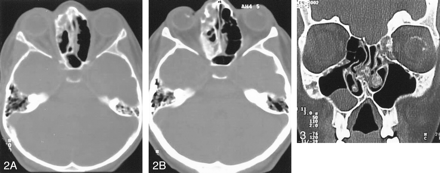 Fig 2.