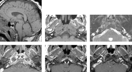 Fig 1.