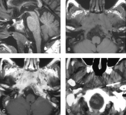 Fig 3.