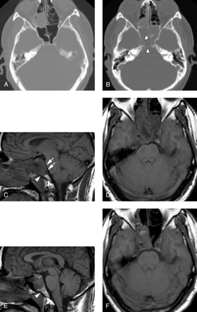 Fig 4.