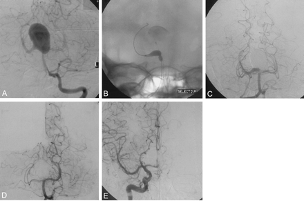 Fig 2.
