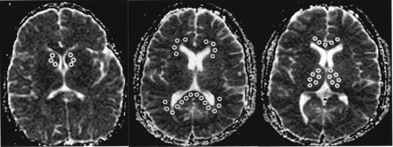 Fig 2.
