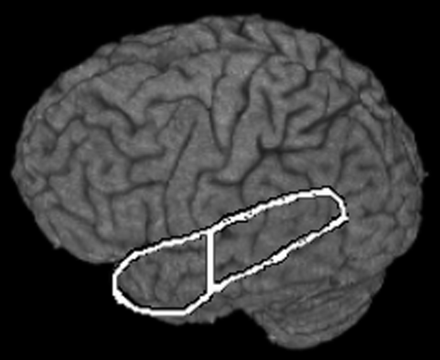 Fig 1.