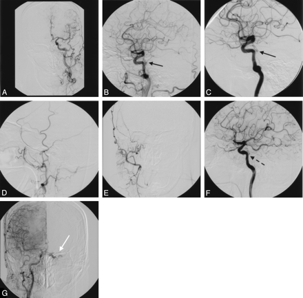 Fig 1.