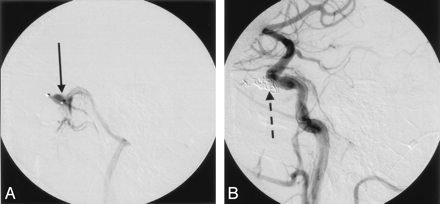 Fig 2.