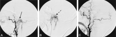 Fig 3.