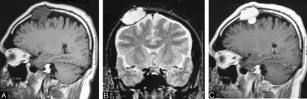 Fig 3.