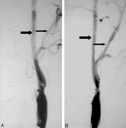 Fig 2.
