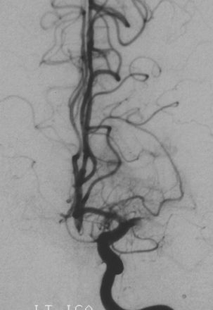 Fig 1.