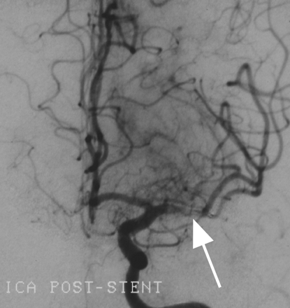 Fig 3.