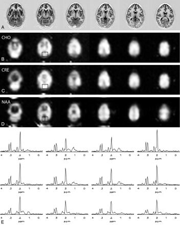 Fig 3.