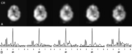 Fig 4.