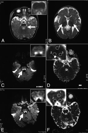 Fig 2.