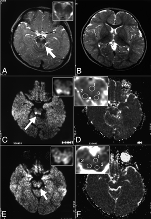 Fig 3.