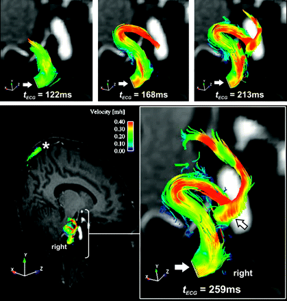 Fig 3.