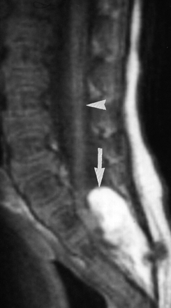 Fig 2.