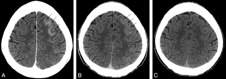 Fig 1.