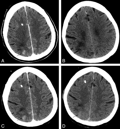 Fig 3.