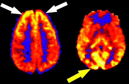 Fig 3.