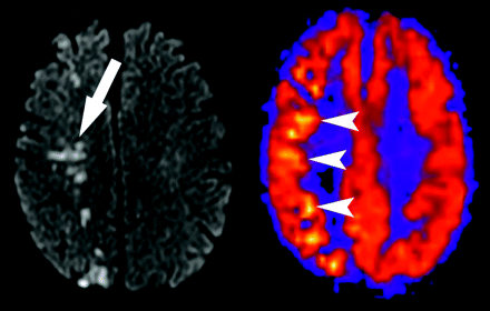 Fig 6.