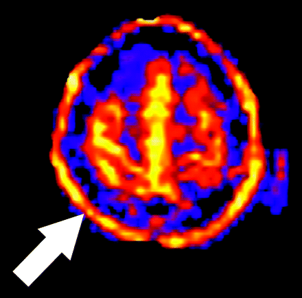 Fig 9.