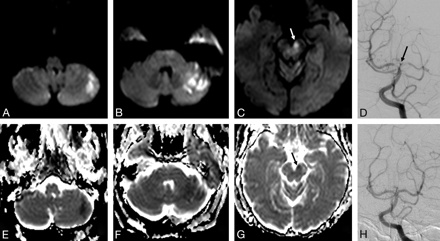 Fig 2.