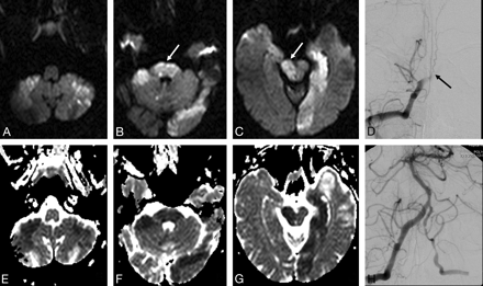 Fig 3.