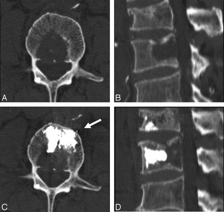 Fig 3.