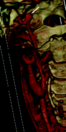Fig 1.